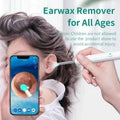 Camera Ear Cleaning (soft tip)