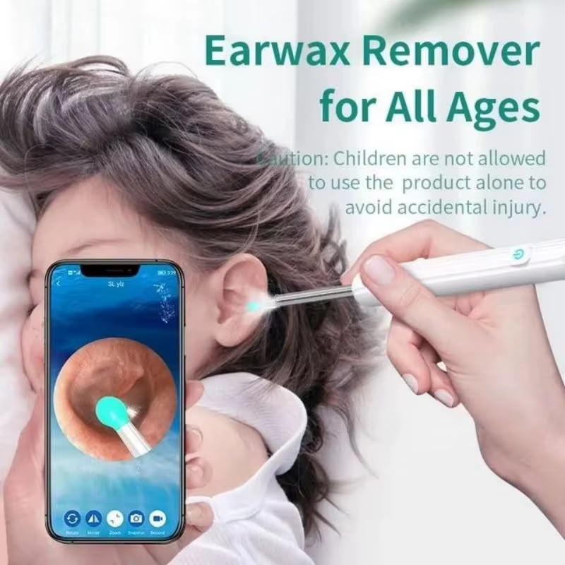 Camera Ear Cleaning (soft tip)
