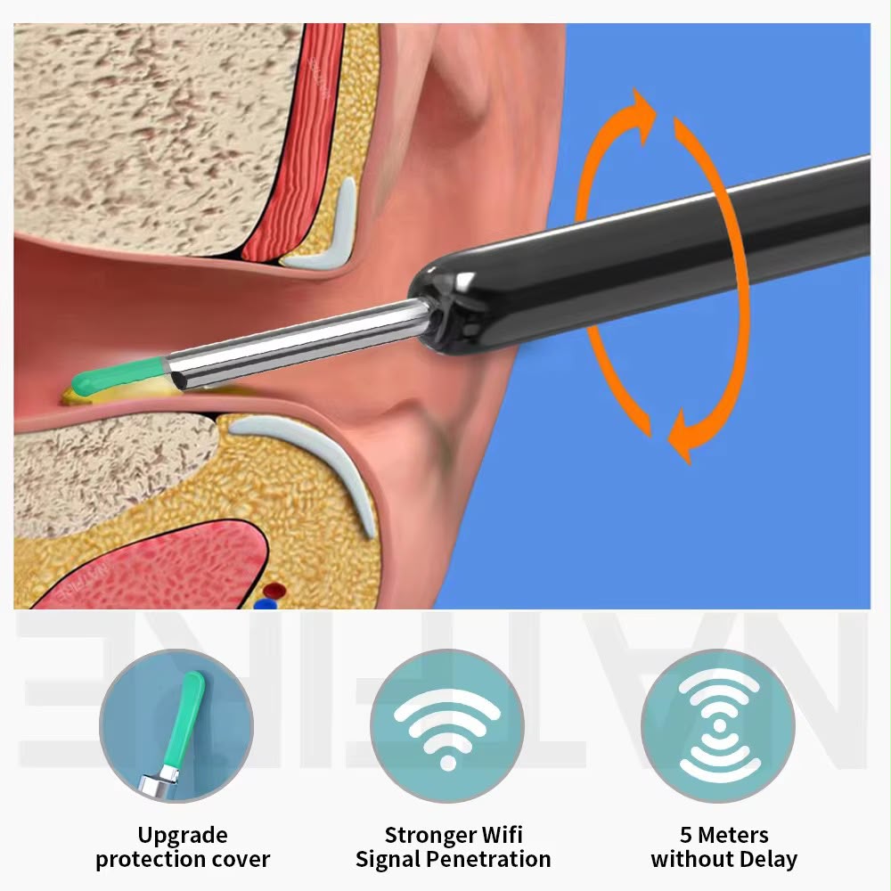 Camera Ear Cleaning (soft tip)